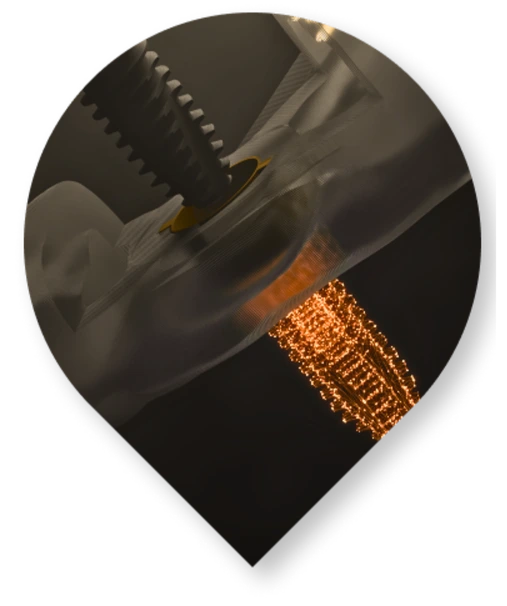 DIO NAVI flapless rehber sistem